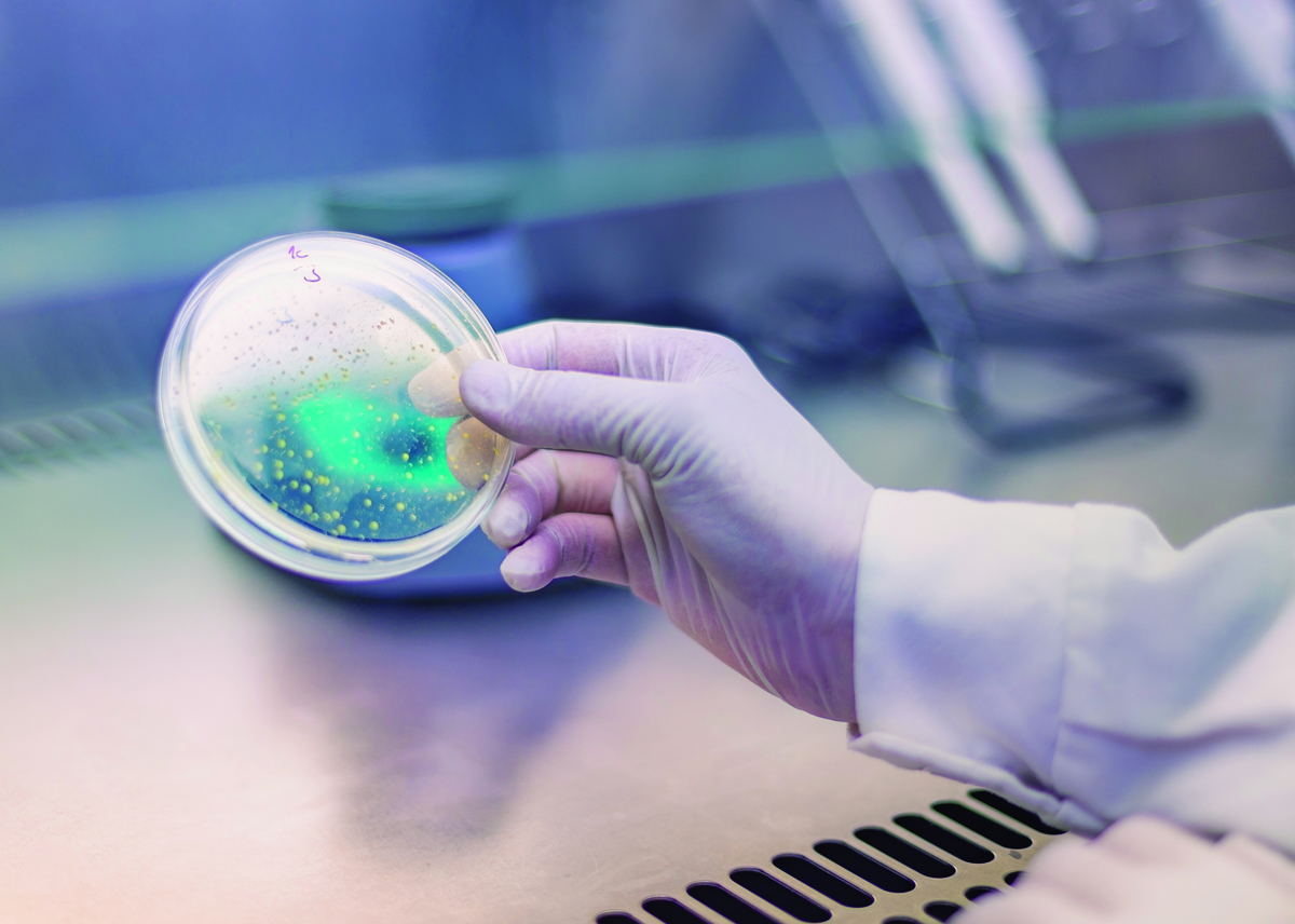 Counting of colonies in microbiology laboratory 